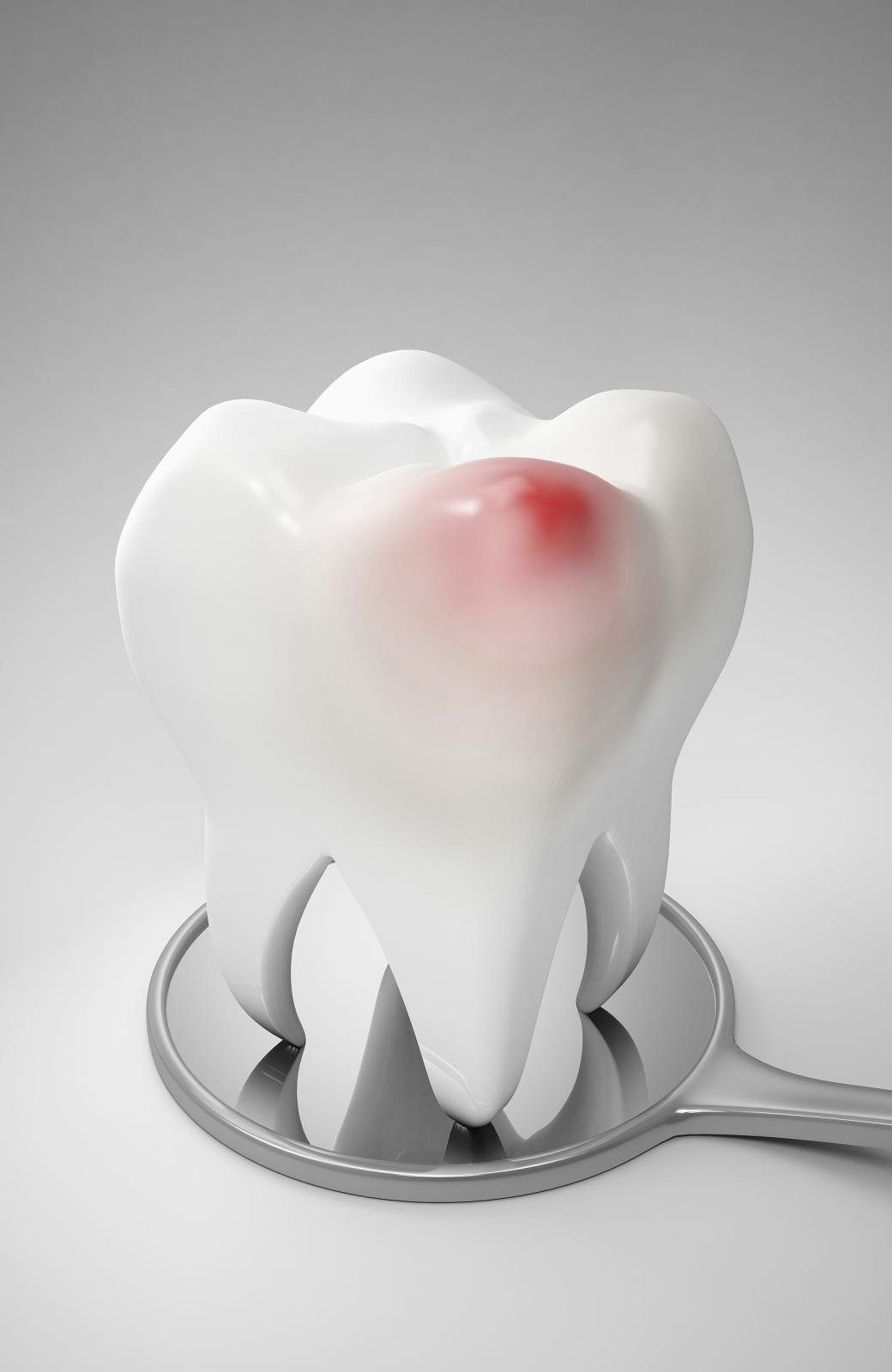 居家(jiā)隔離(lí)期間牙齒出問題，怎麼辦？